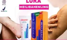 Obat Cream Krim Salep Penghilang Mengobati Luka Kulit Lama Cacar Bekas Jerawat Flek Hitam Keloid