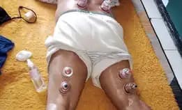 Bekam Basah Panggilan Malang Wa 0895397729844