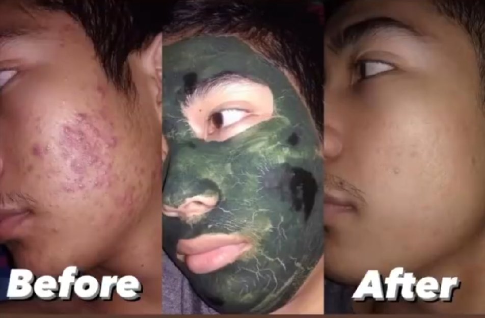 Spakare Spirulina Masker