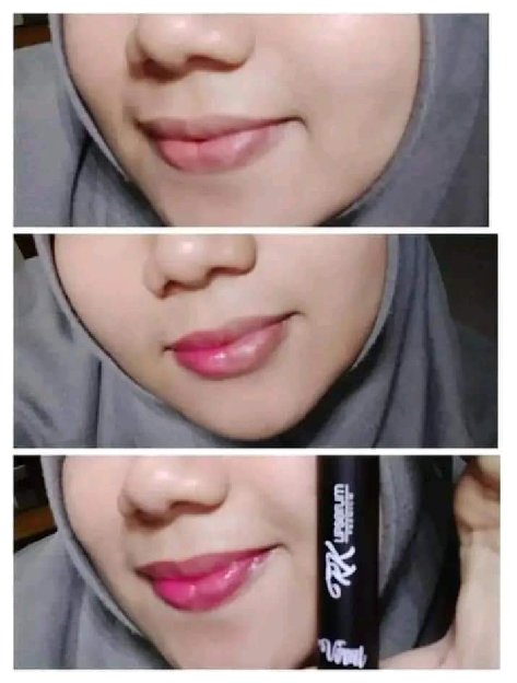 Lipserum Rkglow