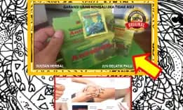0878-8005-8622 Obat Asam Urat Kaki Bengkak Di Kota Palu