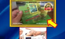 Wa: 0878-8005-8622 Obat Kolesterol Pada Ibu Hamil Di Kota Palu