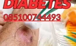 085100744493 Solusi Luka Diabetes Di Semarang: Klinik Terbaik Harga Bersahabat