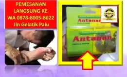 Wa: 0878-8005-8622 Obat Asam Urat Apa Di Kota Palu